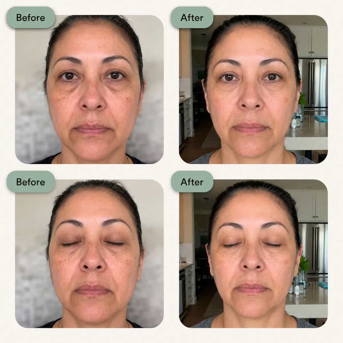 NAD+ patch results before and after